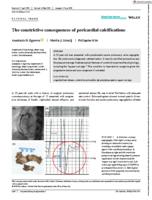 The constrictive consequences of pericardial calcifications