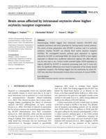 Brain areas affected by intranasal oxytocin show higher oxytocin receptor expression
