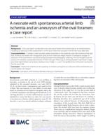 A neonate with spontaneous arterial limb ischemia and an aneurysm of the oval foramen