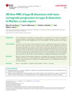 4D flow MRI of type B dissection with later retrograde progression to type A dissection in Marfan