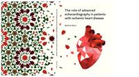 The role of advanced echocardiography in patients with ischemic heart disease