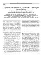 Expanding the spectrum of EWSR1-NFATC2-rearranged benign tumors a common genomic abnormality in vascular malformation/hemangioma and simple bone cyst