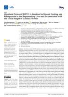 Oncofetal protein CRIPTO is involved in wound healing and fibrogenesis in the regenerating liver and is associated with the initial stages of cardiac fibrosis