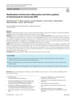 Manifestations of intraocular inflammation over time in patients on brolucizumab for neovascular AMD