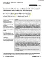 Assessment of human fetal cardiac autonomic nervous system development using color tissue Doppler imaging