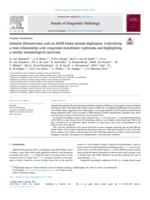 Infantile fibrosarcoma with an EGFR kinase domain duplication