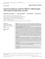 Segmented simultaneous multi-slice diffusion-weighted imaging with navigated 3D rigid motion correction