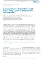 Esophageal tumor segmentation in CT images using a Dilated Dense Attention Unet (DDAUnet)
