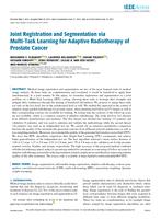 Joint registration and segmentation via multi-task learning for adaptive radiotherapy of prostate cancer