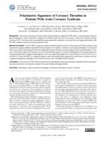 Polarimetric signatures of coronary thrombus in patients with acute coronary syndrome