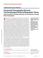 Computed tomography-derived transesophageal echocardiographic views step forward for procedural planning of transcatheter tricuspid valve annuloplasty