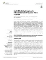 Multi-modality imaging for interventions in tricuspid valve disease
