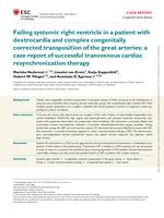Failing systemic right ventricle in a patient with dextrocardia and complex congenitally corrected transposition of the great arteries