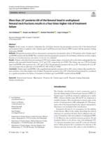 More than 20 degrees posterior tilt of the femoral head in undisplaced femoral neck fractures results in a four times higher risk of treatment failure