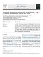 Diffusion tensor MRI tractography reveals increased fractional anisotropy (FA) in arcuate fasciculus following music-cued motor training