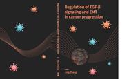 Regulation of TGF-β signaling and EMT in cancer progression