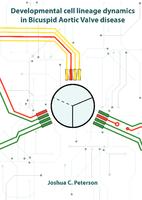 Developmental cell lineage dynamics in Bicuspid Aortic Valve disease