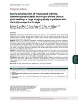 During development of rheumatoid arthritis, intermetatarsal bursitis may occur before clinical joint swelling