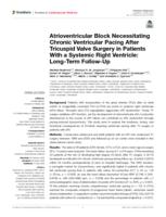 Atrioventricular block necessitating chronic ventricular pacing After tricuspid valve surgery in patients with a systemic right ventricle: