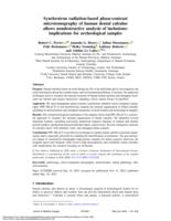 Synchrotron radiation-based phase-contrast microtomography of human dental calculus allows nondestructive analysis of inclusions