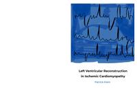 Left ventricular reconstruction in ischemic cardiomyopathy