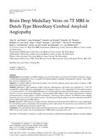 Brain deep medullary veins on 7T MRI in Dutch-type hereditary cerebral amyloid angiopathy