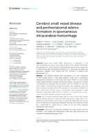 Cerebral small vessel disease and perihematomal edema formation in spontaneous intracerebral hemorrhage