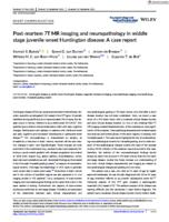 Post-mortem 7T MR imaging and neuropathology in middle stage juvenile-onset Huntington disease