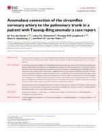 Anomalous connection of the circumflex coronary artery to the pulmonary trunk in a patient with Taussig-Bing anomaly