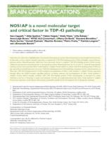 NOS1AP is a novel molecular target and critical factor in TDP-43 pathology