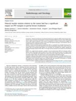 Fiducial marker motion relative to the tumor bed has a significant impact on PTV margins in partial breast irradiation