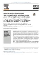 Quantification of near-infrared fluorescence imaging with indocyanine green in free flap breast reconstruction