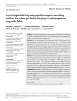 Arterial spin labeling using spatio-temporal encoding readout for robust perfusion imaging in inhomogenous magnetic fields