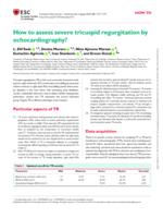 How to assess severe tricuspid regurgitation by echocardiography?