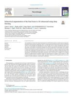 Subcortical segmentation of the fetal brain in 3D ultrasound using deep learning