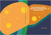 Percutaneous hepatic perfusion in unresectable liver metastases