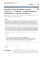 MRI of diffuse-type tenosynovial giant cell tumour in the knee: a guide for diagnosis and treatment response assessment