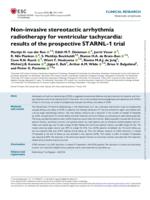 Non-invasive stereotactic arrhythmia radiotherapy for ventricular tachycardia