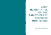 Daily quantitative MRI for radiotherapy response monitoring