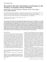 Microtubule plus-end conformations and dynamics in the periphery of interphase mouse fibroblasts