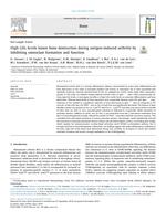 High LDL levels lessen bone destruction during antigen-induced arthritis by inhibiting osteoclast formation and function