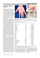 Acrocyanosis after neoadjuvant ipilimumab plus nivolumab: a case report