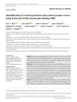 Quantification of cerebral perfusion and cerebrovascular reserve using Turbo-QUASAR arterial spin labeling MRI