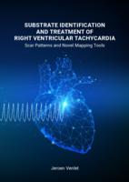 Substrate identification and treatment of right ventricular tachycardia