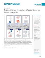 Protocol for ex vivo culture of patient-derived tumor fragments
