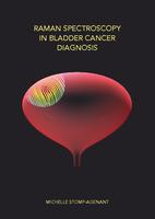 Raman spectroscopy in bladder cancer diagnosis