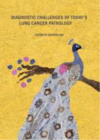 Diagnostic challenges of today's lung cancer pathology