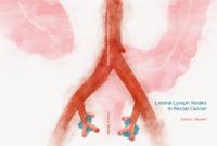 Lateral lymph nodes in rectal cancer