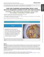 Aortic valve visualization and pressurization device: a novel device for intraoperative evaluation of aortic valve repair procedures