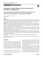 Intraoperative molecular imaging of colorectal lung metastases with SGM-101